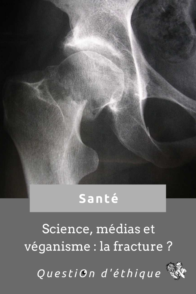 Épingle « Science, médias et véganisme : la fracture ? » pour partager l'article sur Pinterest 